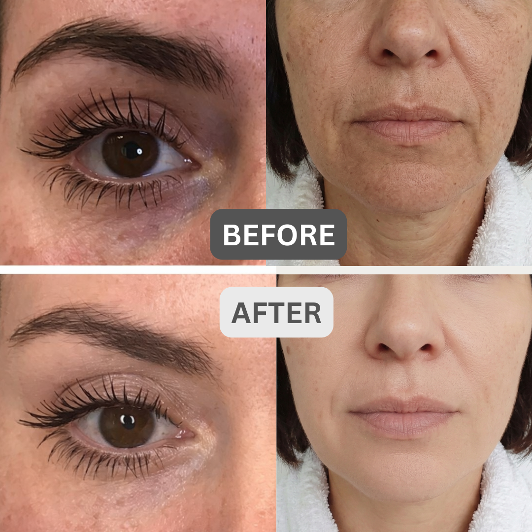 Before and after facial skin improvement showing under-eye area and overall skin texture after holistic skin routine and facial massage.