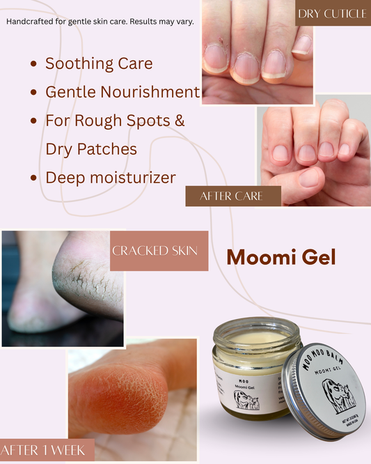 Moo Moo Balm Moomi Gel before and after results showing healing of cracked heels and dry cuticles, handcrafted tallow balm providing soothing care, deep moisturizer, and nourishment for rough skin.