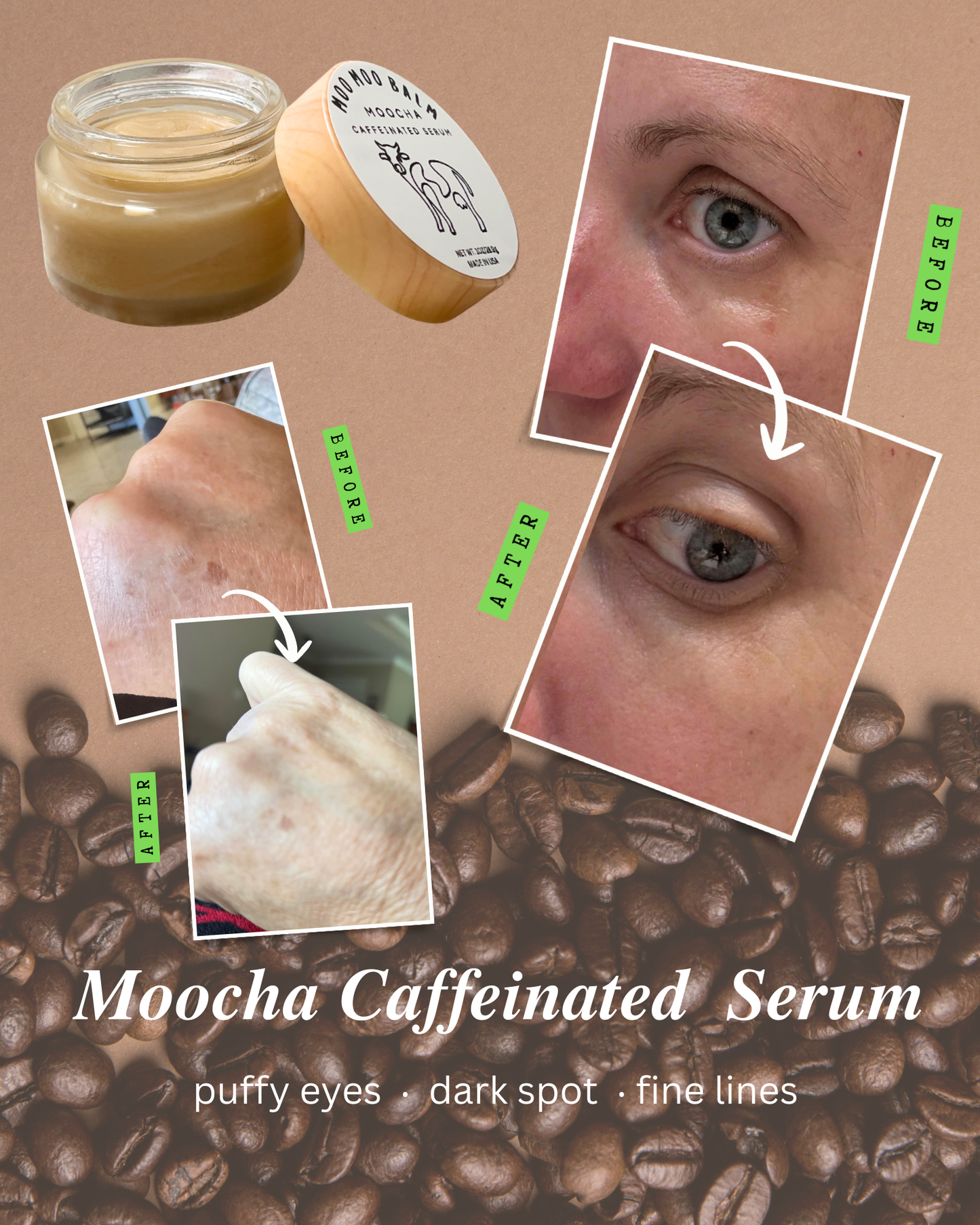 Moo Moo Balm Moocha Caffeinated Serum before and after results showing improvement in puffy eyes, dark spots, and fine lines — tallow-based natural caffeine eye treatment with visible skin brightening.